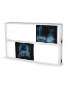 NEGATIVOSCOPI A PARETE CM. 80x43H