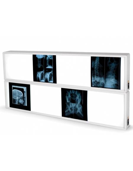 NEGATIVOSCOPI DA PARETE AMBULATORIALI CM. 120X43 NEGATIVOSCOPI DA PARETE AMBULATORIALI CM. 120X43