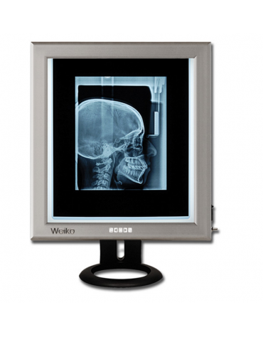 Negativoscopio ultrapiatto x-ray con tecnologia a led