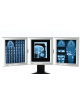 Negativoscopio da tavolo triplo ultrapiatto x-ray con tecnologia a led - 3 schermi x cm 46x3x50,5h